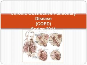 Chronic Obstructive Pulmonary Disease COPD Spring 2014 References