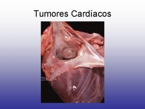 Tumores Cardacos Definio Neoplasias benignas e malignas que