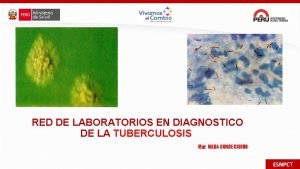 RED DE LABORATORIOS EN DIAGNOSTICO DE LA TUBERCULOSIS