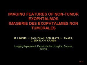 IMAGING FEATURES OF NONTUMOR EXOPHTALMOS IMAGERIE DES EXOPHTALMIES