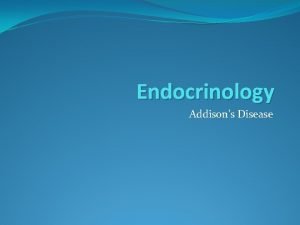 Endocrinology Addisons Disease Addisons disease Prevalence 1 in