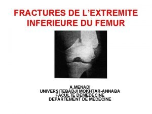 FRACTURES DE LEXTREMITE INFERIEURE DU FEMUR A MENADI