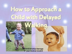 Approach to child with delayed walking