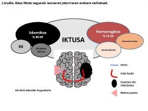 1 Irudia Iktus Mota nagusiak lesioaren jatorriaren arabera