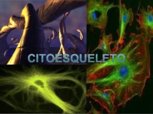 Un entramado tridimensional de proteínas