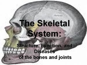 Bone deformities