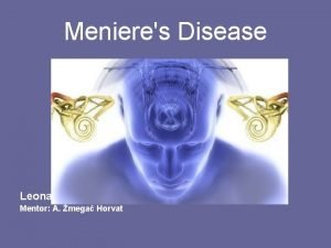 Menieres Disease Leona upljika Gabelica Mentor A mega