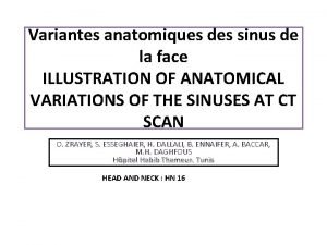 Procidence canal carotidien