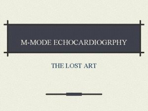 Echocardiogrphy
