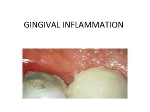 Gingival anoxemia