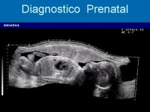 Diagnostico Prenatal Diagnstico Prenatal Hoy en da se