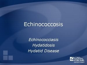 Echinococciasis