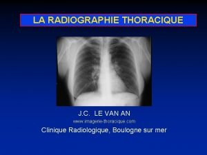 LA RADIOGRAPHIE THORACIQUE J C LE VAN AN