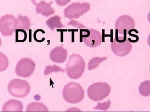 DIC TTP HUS DIC Disszeminlt intravaszkulris coagulopathia DIC