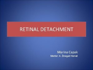 RETINAL DETACHMENT Marina Capak Mentor A mega Horvat