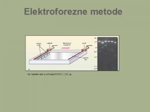 Elektroforezne metode Naboj na molekuli DNA http cnx
