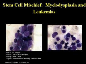 Stem Cell Mischief Myelodysplasia and Leukemias John M