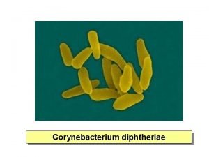 Corynebacterium diphtheriae aerobic or anaerobic