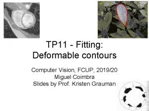 TP 11 Fitting Deformable contours Computer Vision FCUP