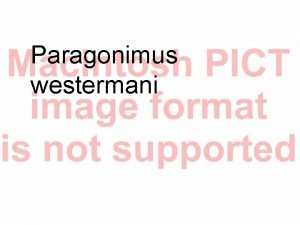 Paragonimus westermani PARAGONIMUS WESTERMANI Diagenetic Trematode Infects the