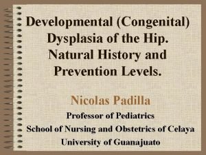 Developmental Congenital Dysplasia of the Hip Natural History