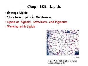 Chap 10 B Lipids Storage Lipids Structural Lipids