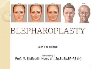 BLEPHAROPLASTY oleh dr Frederik Pembimbing Prof M Sjaifuddin