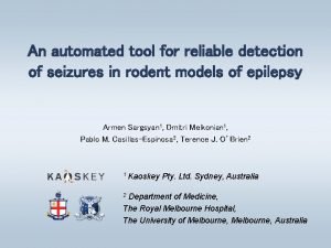 An automated tool for reliable detection of seizures