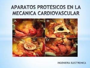 INGENIERIA ELECTRONICA Las prtesis valvulares cardacas pueden ser