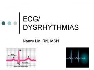 ECG DYSRHYTHMIAS Nancy Lin RN MSN Reading Assignment