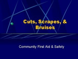 Cuts Scrapes Bruises Community First Aid Safety Cuts
