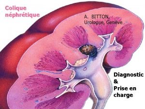 Colique nphrtique A BITTON Urologue Genve Diagnostic Prise