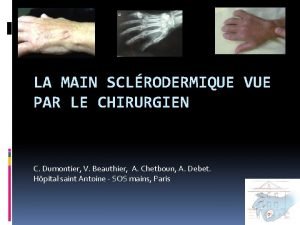 LA MAIN SCLRODERMIQUE VUE PAR LE CHIRURGIEN C