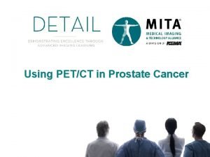 Using PETCT in Prostate Cancer Legal Disclaimer These