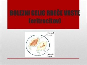 BOLEZNI CELIC RDEE VRSTE eritrocitov ANEMIJA SLABOKRVNOST Je