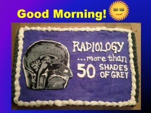 Good Morning CHEST RADIOGRAPHS More Than 50 Shades