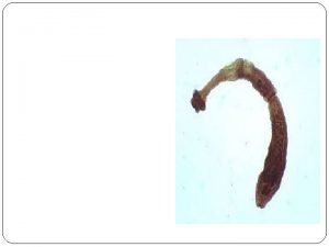 Hepatic abscess mri Hepatic abscess mri