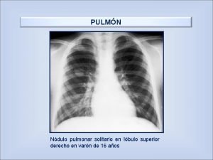 PULMN Ndulo pulmonar solitario en lbulo superior derecho