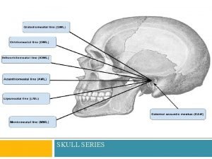 Pa caldwell facial bones positioning