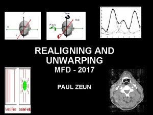 REALIGNING AND UNWARPING MFD 2017 PAUL ZEUN What