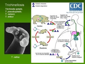 Trichinella spiralis distribucion geografica