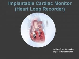 Implantable Cardiac Monitor Heart Loop Recorder Kaitlyn Chin