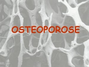 OSTEOPOROSE O QUE Osteoporose que significa osso poroso