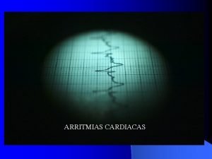 ARRITMIAS CARDIACAS Estudio electrofisiologico Auricula derecha Plano tricuspideo