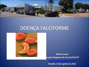 DOENA FALCIFORME Melina Swain Hospital Regional da Asa