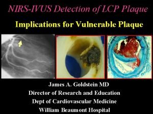 NIRSIVUS Detection of LCP Plaque Implications for Vulnerable