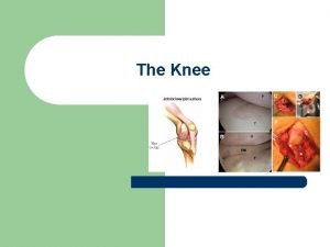 The Knee Bones of the Knee Joint l