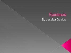 Epistaxis By Jessica Davies What is Epistaxis Epistaxis