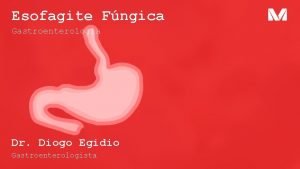 Esofagite Fngica Gastroenterologia Dr Diogo Egidio Gastroenterologista Conceito