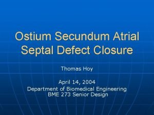 Ostium Secundum Atrial Septal Defect Closure Thomas Hoy